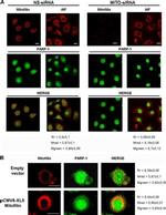 Mitofilin Antibody in Immunocytochemistry (ICC/IF)