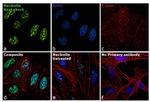 Nucleolin Antibody in Immunocytochemistry (ICC/IF)