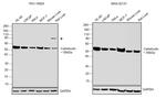 Calreticulin Antibody