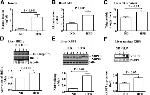 Phospho-IRE1 alpha (Ser724) Antibody in Western Blot (WB)