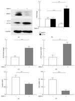 LC3A/LC3B Antibody in Western Blot (WB)