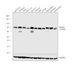 DNM1L Antibody in Western Blot (WB)