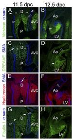 Versican V0, V1 Neo Antibody in Immunocytochemistry (ICC/IF)