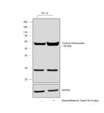 Tyrosine Hydroxylase Antibody