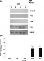 MBP Antibody in Western Blot (WB)