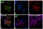 SLP76 Antibody in Immunocytochemistry (ICC/IF)