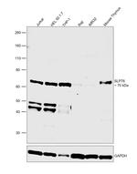 SLP76 Antibody in Western Blot (WB)