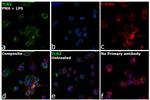 TLR2 Antibody