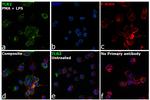 TLR2 Antibody in Immunocytochemistry (ICC/IF)