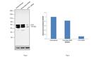 alpha-1 Antitrypsin Antibody in Western Blot (WB)