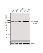 XPB Antibody in Western Blot (WB)