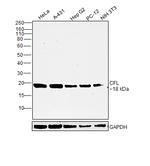 Cofilin Antibody in Western Blot (WB)