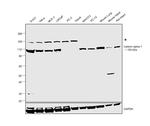 Catenin alpha-1 Antibody in Western Blot (WB)