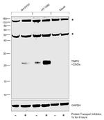 TIMP2 Antibody in Western Blot (WB)