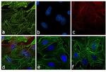 Rat IgG (H+L) Secondary Antibody in Immunocytochemistry (ICC/IF)