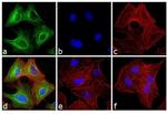 Rat IgG (H+L) Secondary Antibody in Immunocytochemistry (ICC/IF)