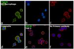 TGF beta-1 Antibody in Immunocytochemistry (ICC/IF)