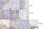 beta Tubulin Antibody in Immunohistochemistry (IHC)