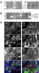 Estrogen Receptor alpha Antibody in Immunohistochemistry (IHC)