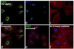 SOD2 Antibody in Immunocytochemistry (ICC/IF)