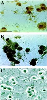 Estrogen Receptor beta Antibody in Immunohistochemistry (IHC)