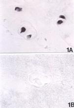 Estrogen Receptor beta Antibody in Immunohistochemistry (IHC)