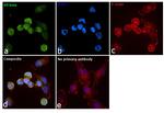 Estrogen Receptor beta Antibody in Immunocytochemistry (ICC/IF)