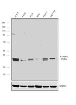 ATP6IP2 Antibody in Western Blot (WB)