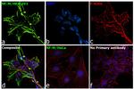 NEFM Antibody in Immunocytochemistry (ICC/IF)