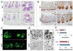 Lysozyme Antibody in Immunohistochemistry (IHC)