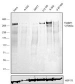 53BP1 Antibody in Western Blot (WB)