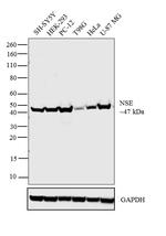 NSE Antibody in Western Blot (WB)