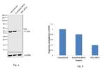 NSE Antibody in Western Blot (WB)