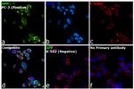 Amyloid Precursor Protein Antibody in Immunocytochemistry (ICC/IF)