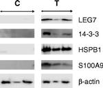 S100A9 Antibody in Western Blot (WB)