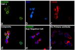 S100A9 Antibody in Immunocytochemistry (ICC/IF)