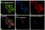 Tyrosine Hydroxylase Antibody