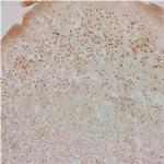 Glucocorticoid Receptor Antibody in Immunohistochemistry (IHC)