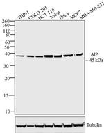 AIP Antibody in Western Blot (WB)