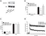 Dynamin 1 Antibody in Western Blot (WB)