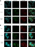 E. coli serotype O/K Antibody in Immunocytochemistry (ICC/IF)