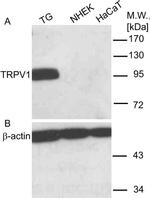 TRPV1 Antibody in Western Blot (WB)