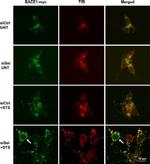 BACE1 Antibody in Immunocytochemistry (ICC/IF)