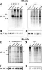 BACE1 Antibody in Immunoprecipitation (IP)