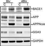 BACE1 Antibody in Western Blot (WB)