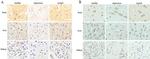 TPH1 Antibody in Immunohistochemistry (Paraffin) (IHC (P))