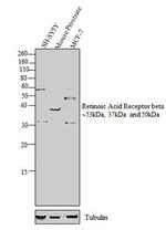 RARB Antibody in Western Blot (WB)