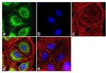 RARB Antibody in Immunocytochemistry (ICC/IF)