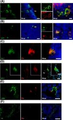 PPAR gamma-2 Antibody in Immunocytochemistry (ICC/IF)