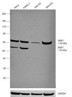 SNX1 Antibody in Western Blot (WB)